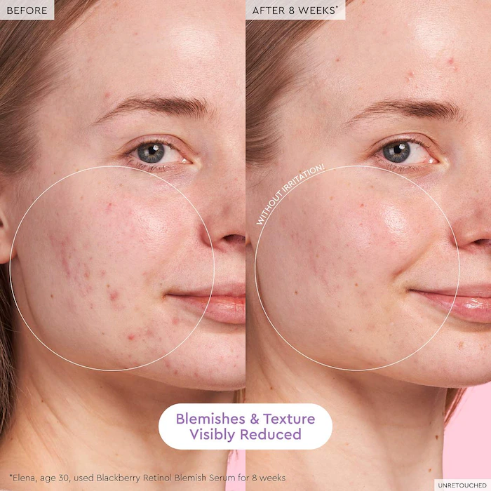 BLACKBERRY RETINOL BLEMISH SERUM